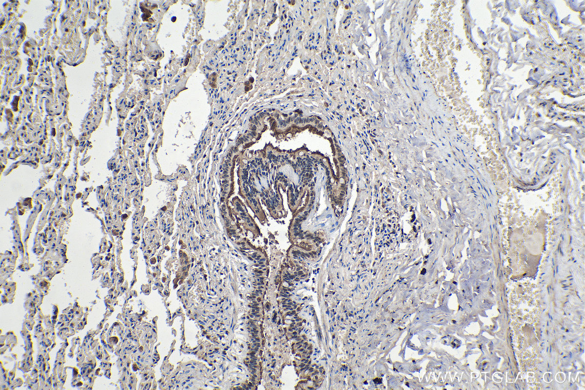 IHC staining of human lung using 12928-1-AP