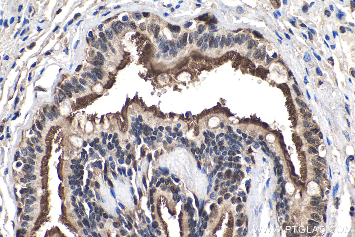 IHC staining of human lung using 12928-1-AP
