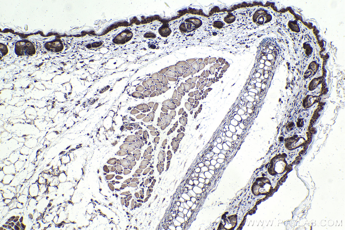 IHC staining of mouse skin using 22392-1-AP