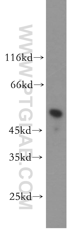 WB analysis of mouse spleen using 18977-1-AP