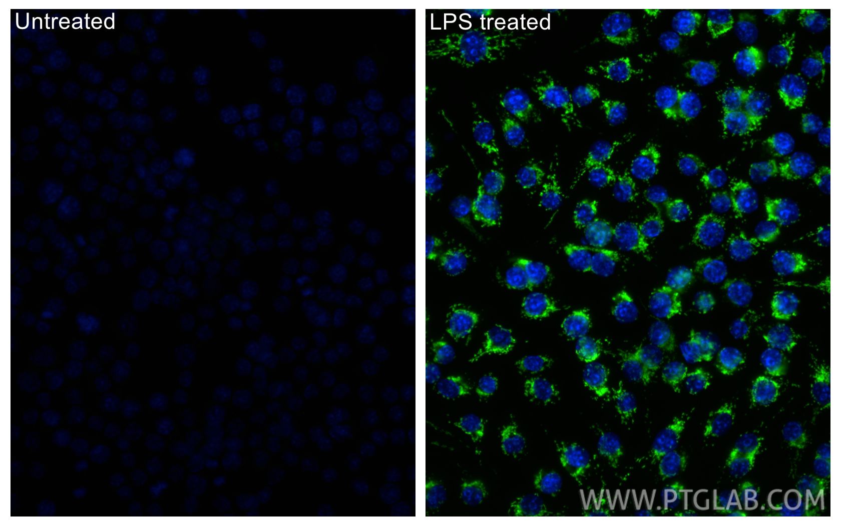 IF Staining of RAW 264.7 using 86725-1-RR IF Staining of RAW 264.7 using 86725-1-RR