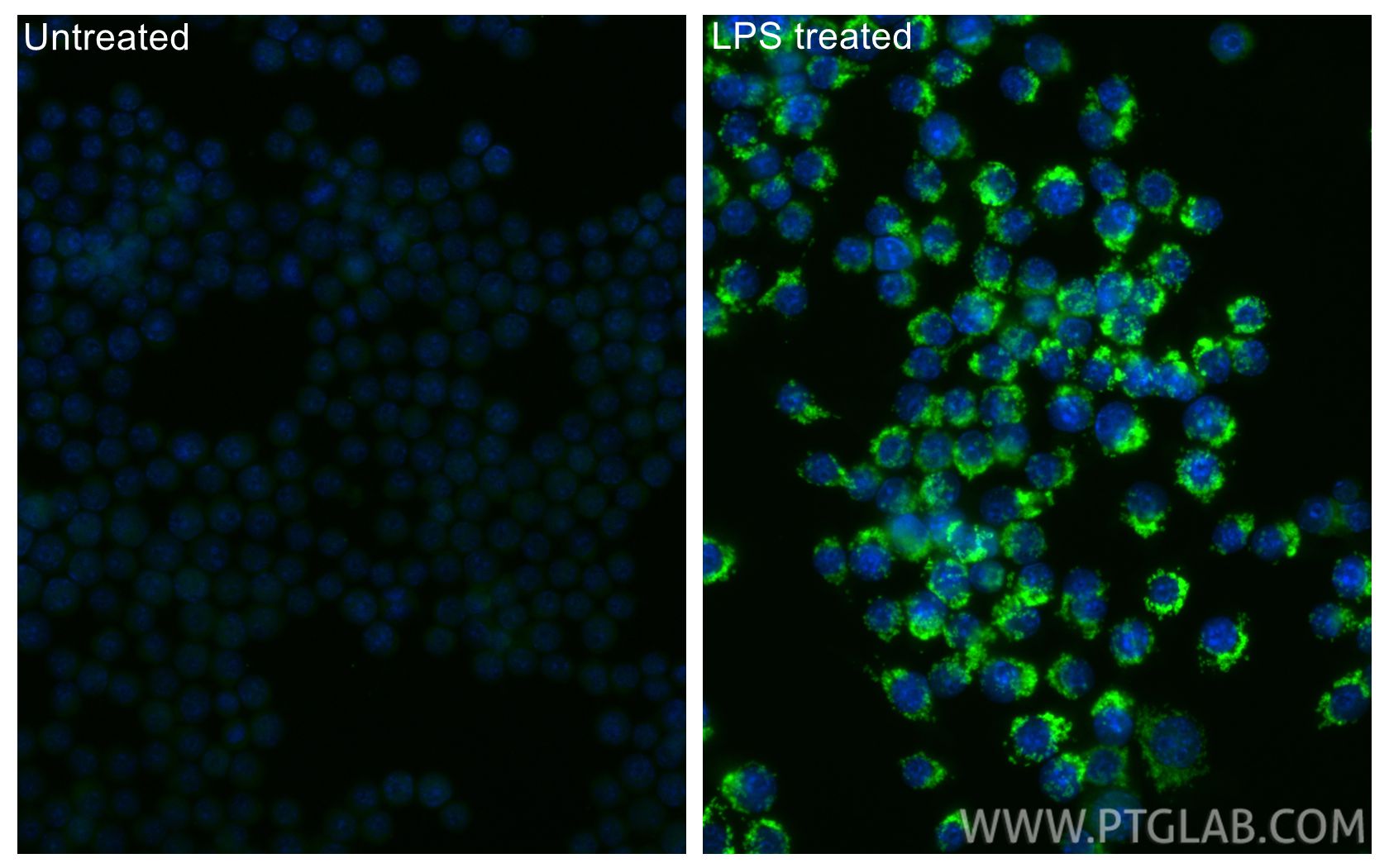 IF Staining of RAW 264.7 using CL488-86725 IF Staining of RAW 264.7 using CL488-86725