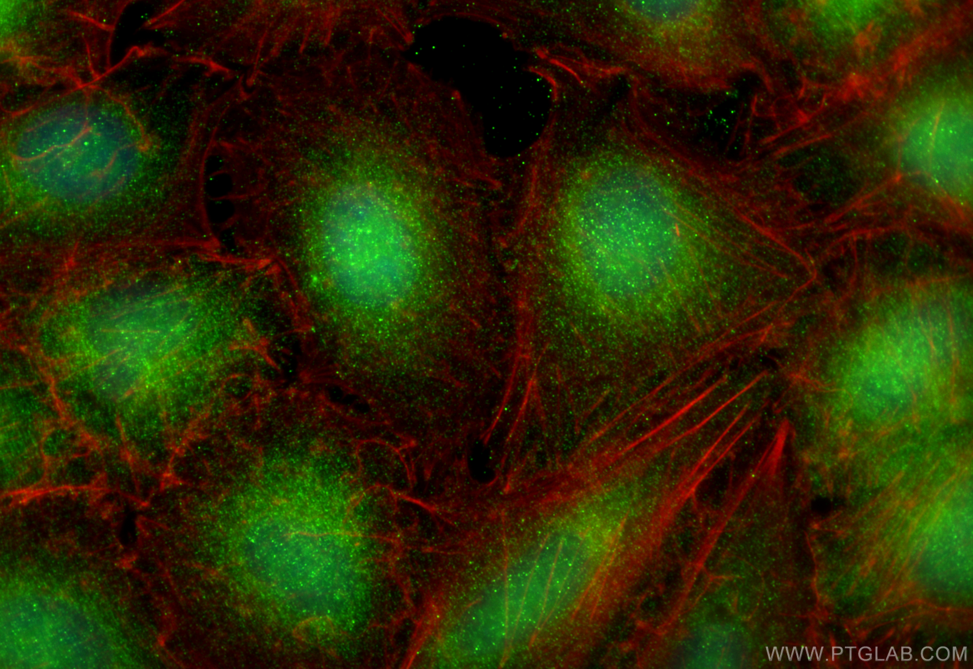 IF Staining of A549 using 17509-1-AP