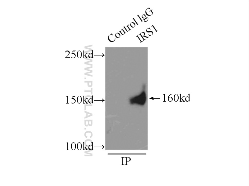 IP experiment of A549 using 17509-1-AP