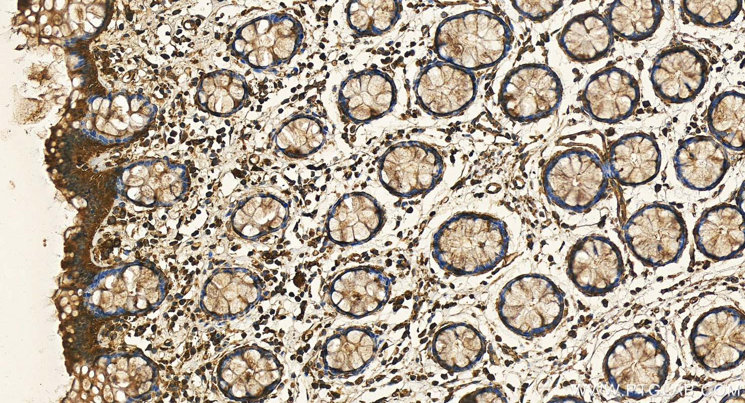 IHC staining of human colon using 82730-10-RR