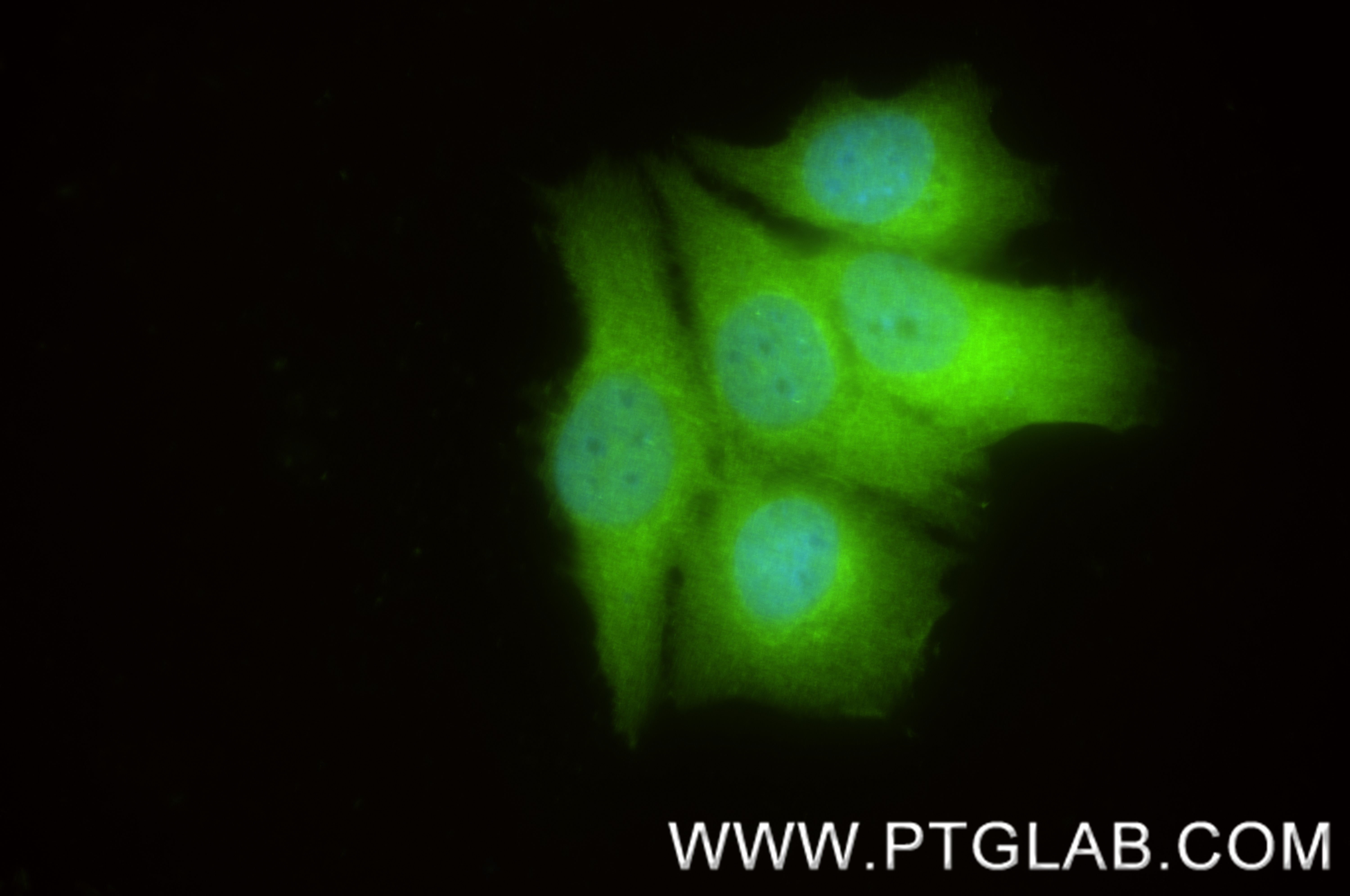 IF Staining of MCF-7 using 82730-10-RR (same clone as 82730-10-PBS)