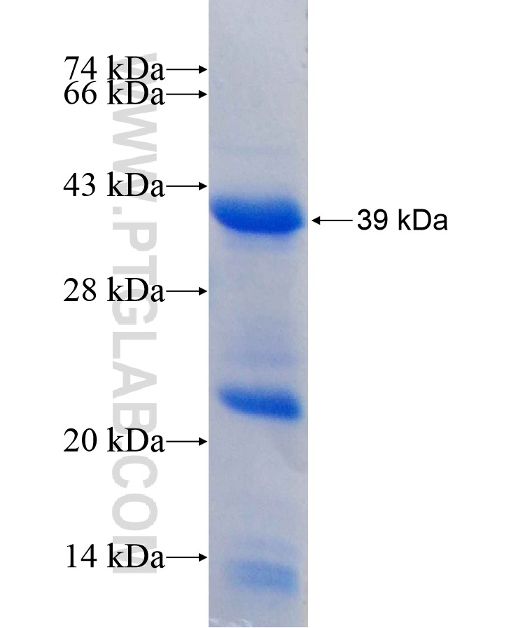 IRS4 fusion protein Ag17485 SDS-PAGE IRS4 fusion protein Ag17485 SDS-PAGE