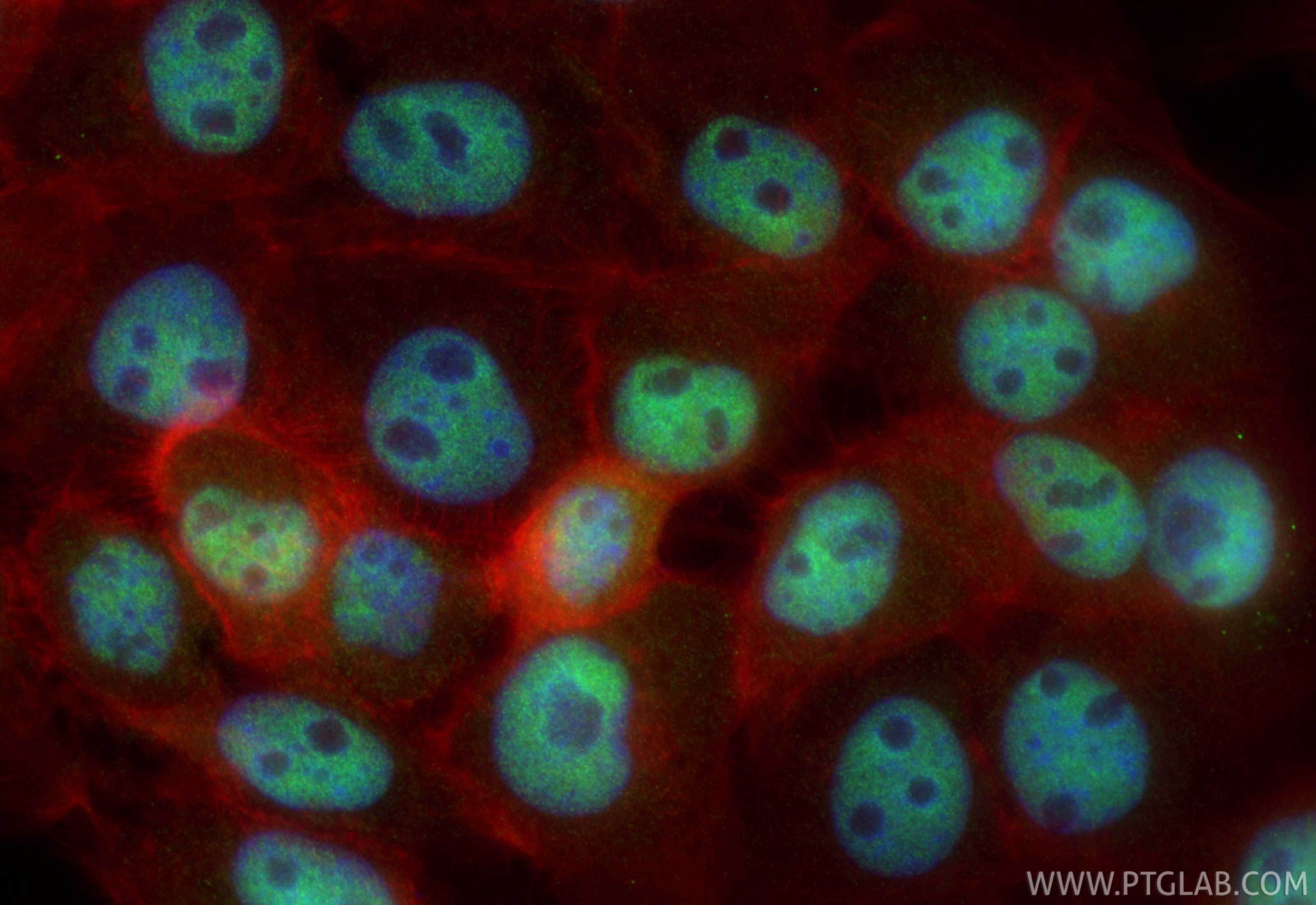 IF Staining of U-251 using 31699-1-AP (same clone as 31699-1-PBS) IF Staining of U-251 using 31699-1-AP (same clone as 31699-1-PBS)
