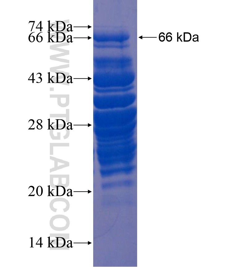 IRX4 fusion protein Ag18015 SDS-PAGE IRX4 fusion protein Ag18015 SDS-PAGE