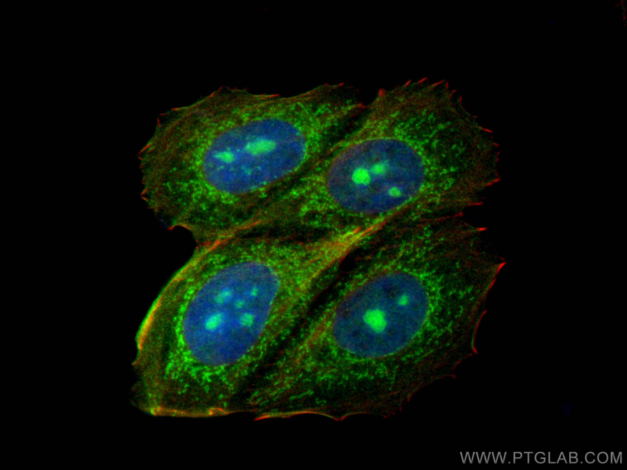 IF Staining of MCF-7 using 14812-1-AP
