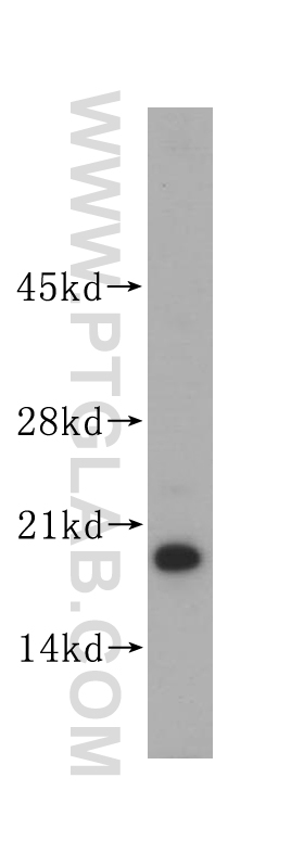 WB analysis of mouse heart using 14812-1-AP