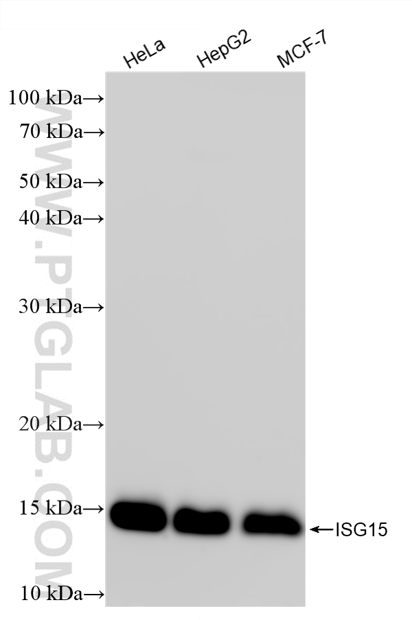 WB analysis using 87799-2-RR (same clone as 87799-2-PBS) WB analysis using 87799-2-RR (same clone as 87799-2-PBS)