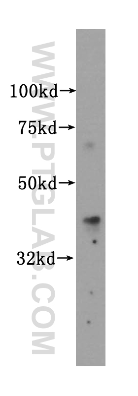 WB analysis of BxPC-3 using 15661-1-AP