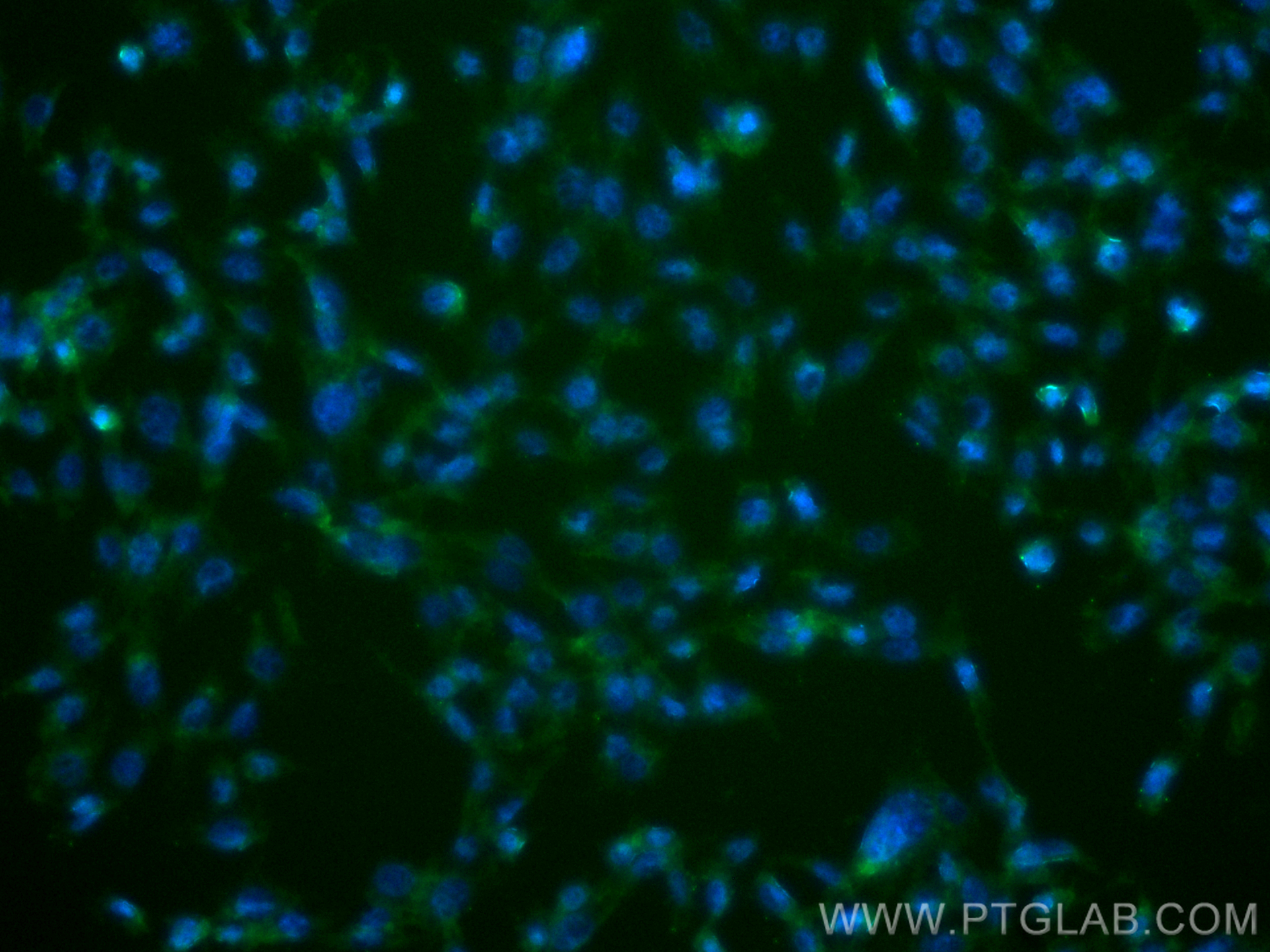 IF Staining of NIH/3T3 using 24306-1-AP