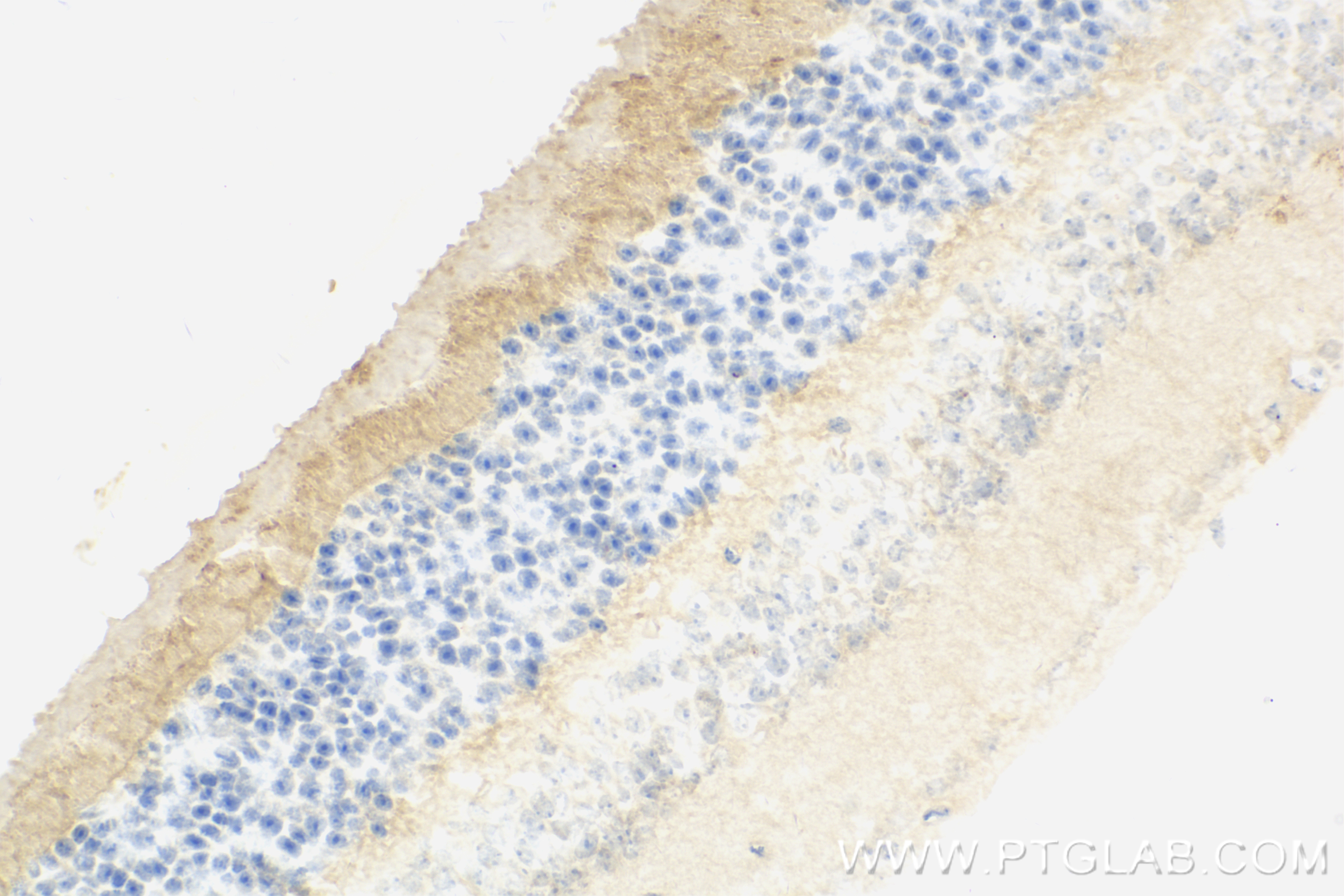 IHC staining of mouse eye using 83782-5-RR
