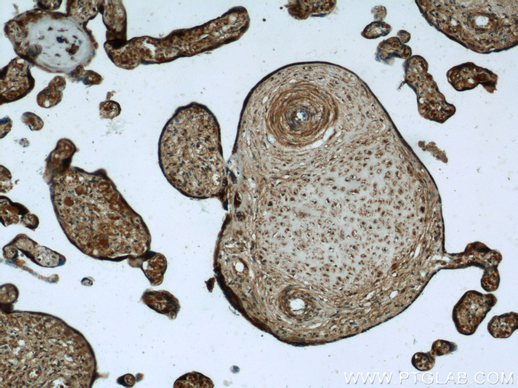IHC staining of human placenta using 21540-1-AP