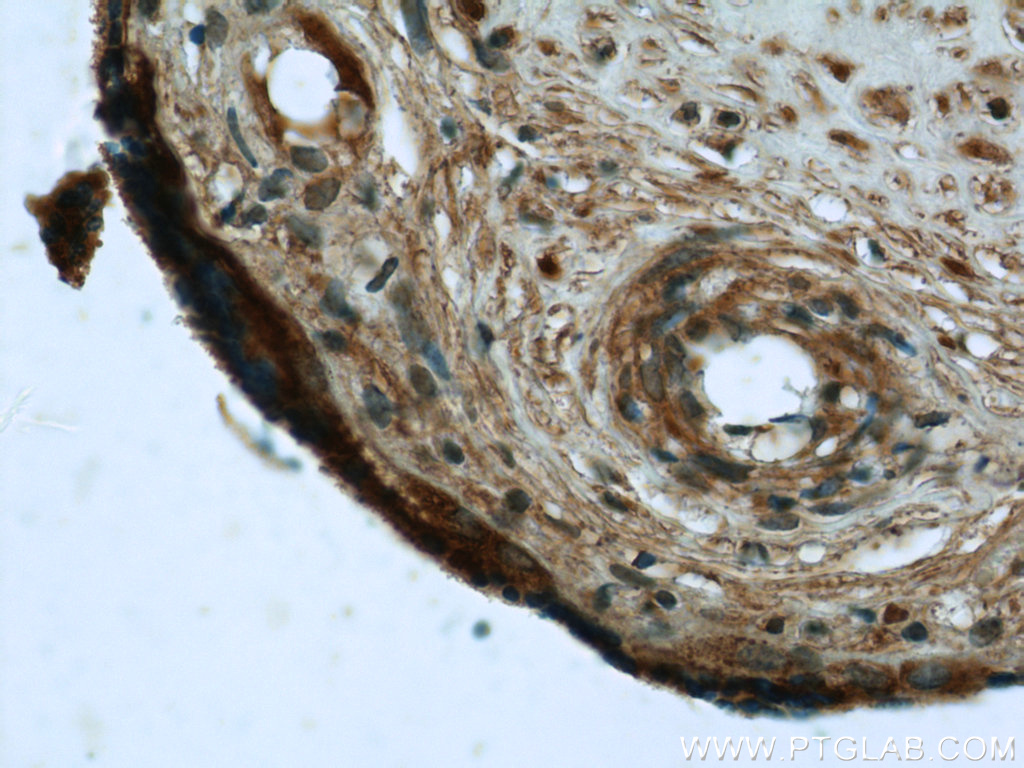 IHC staining of human placenta using 21540-1-AP