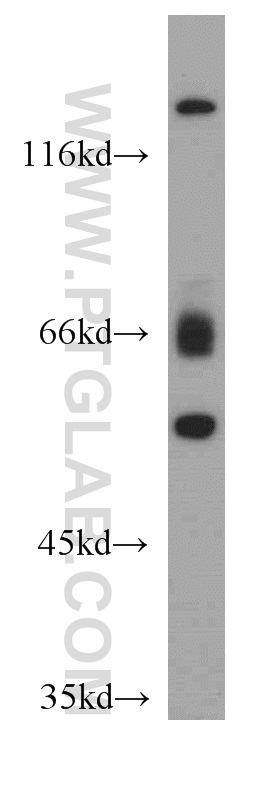 WB analysis of L02 using 21540-1-AP