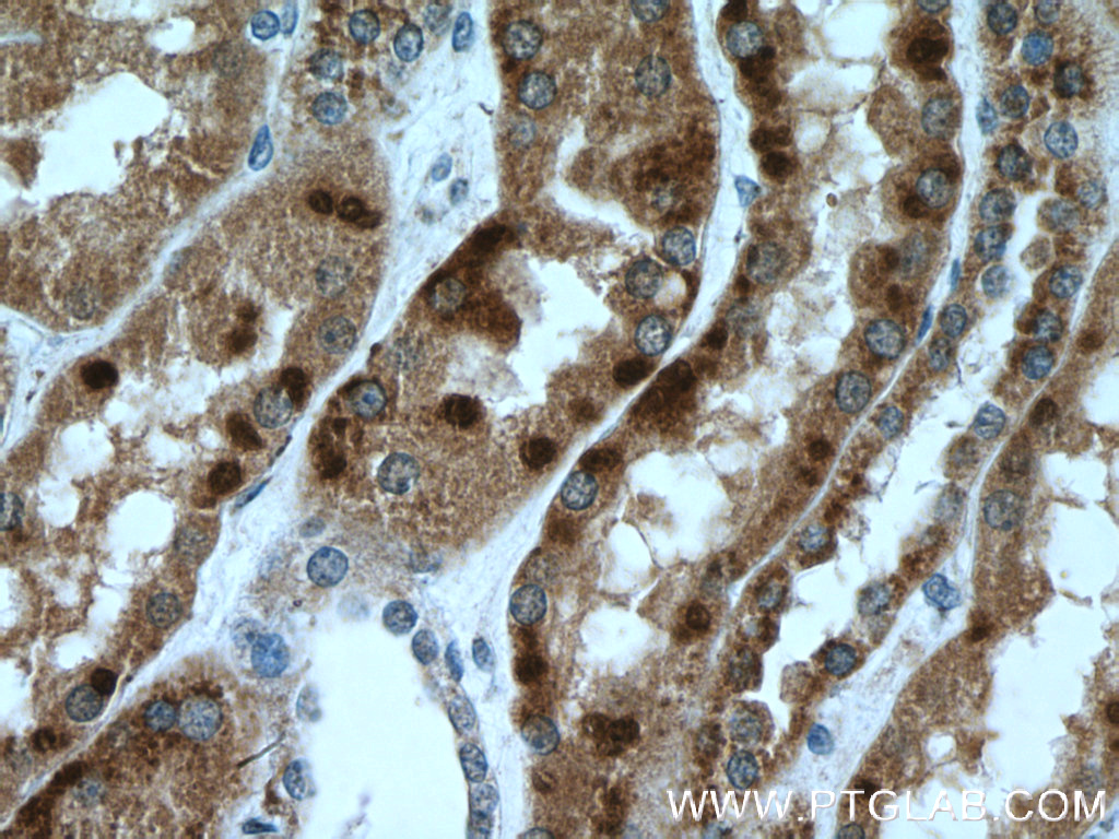 IHC staining of human kidney using 27082-1-AP