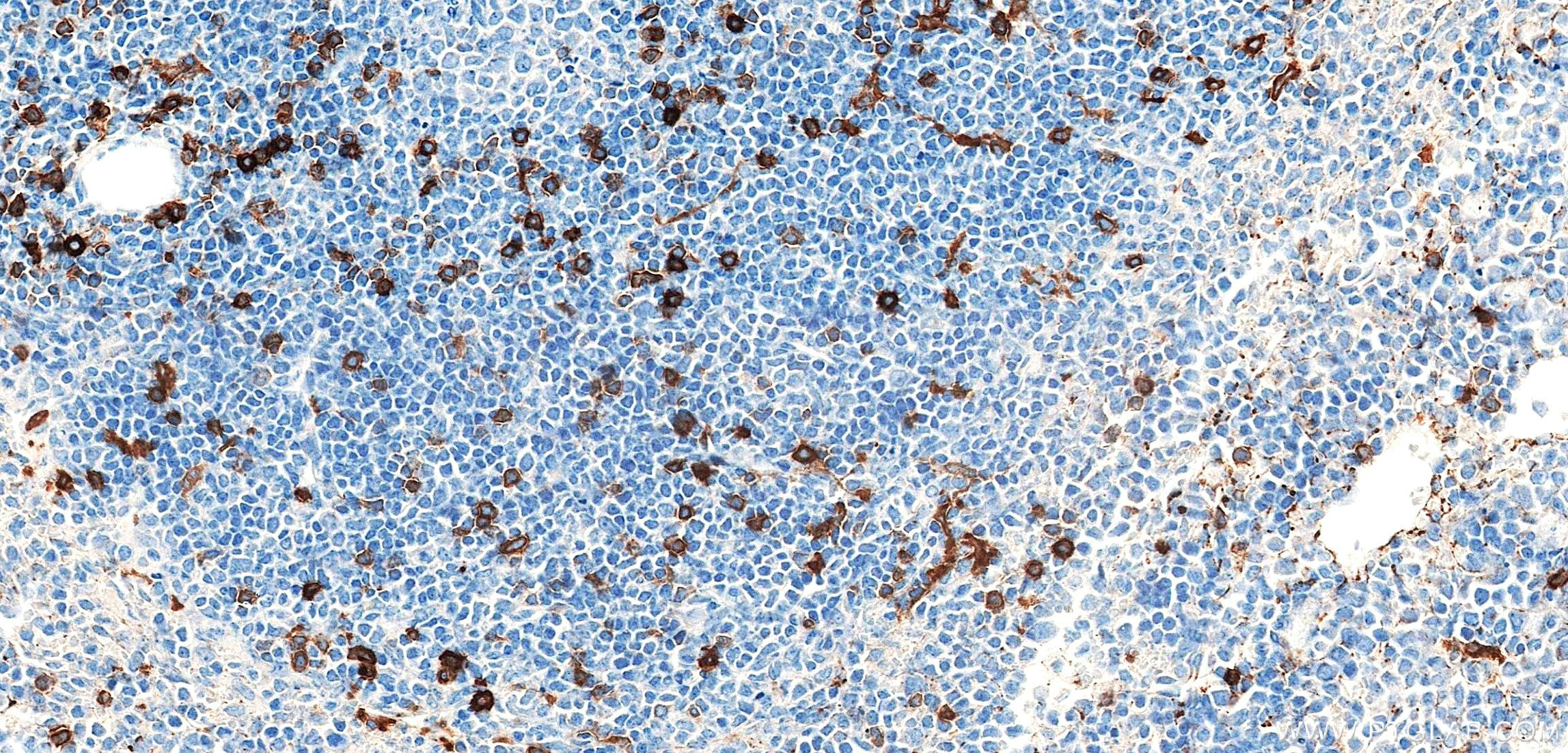 IHC staining of mouse spleen using 87417-1-RR IHC staining of mouse spleen using 87417-1-RR