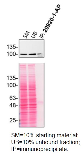 IP experiment of HeLa using 20920-1-AP