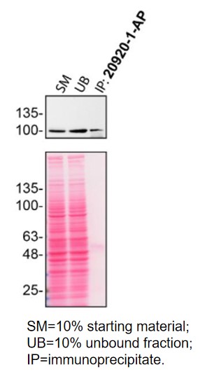 IP experiment of HeLa using 20920-1-AP