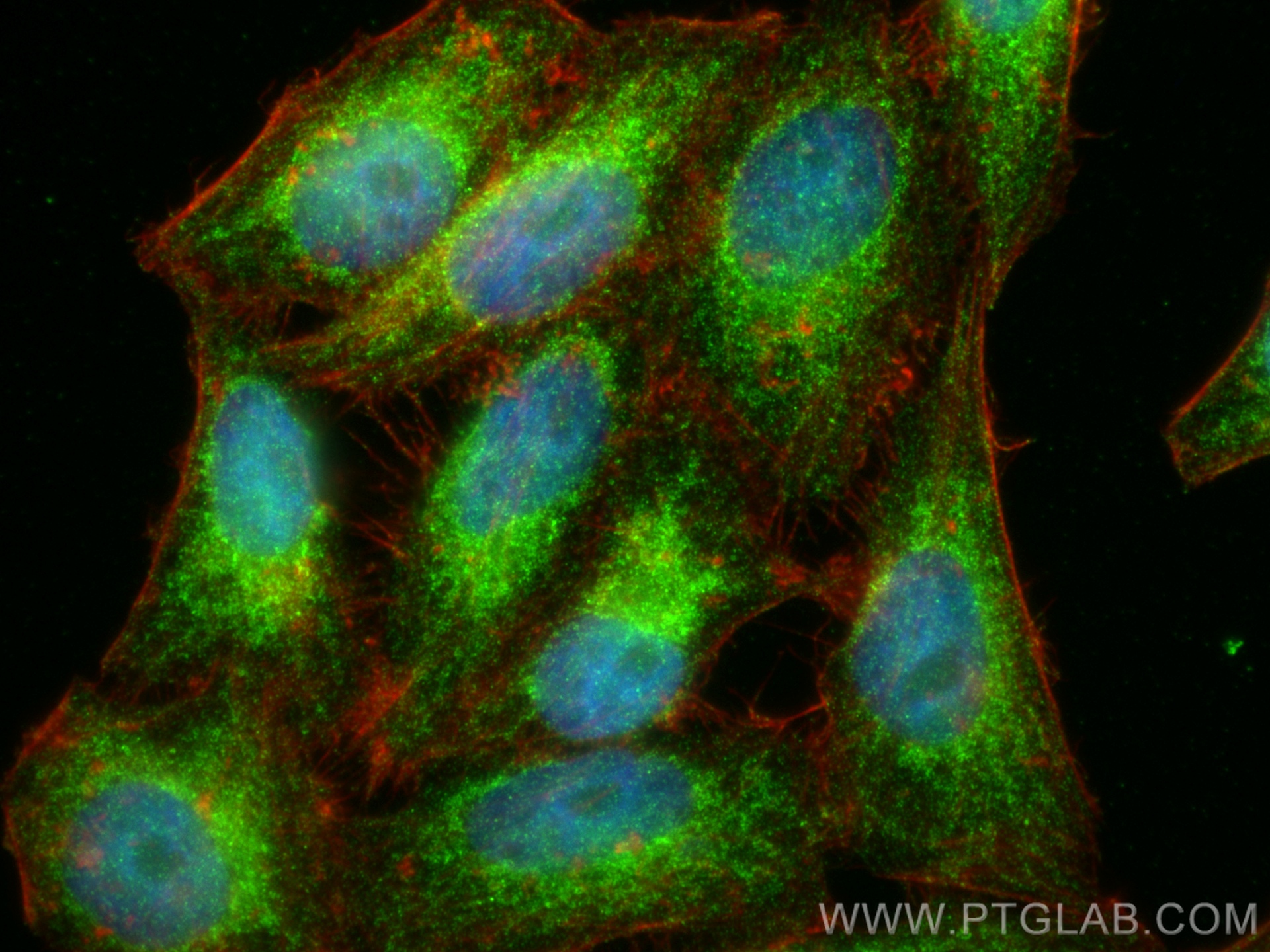 IF Staining of HepG2 using 67757-1-Ig (same clone as 67757-1-PBS)