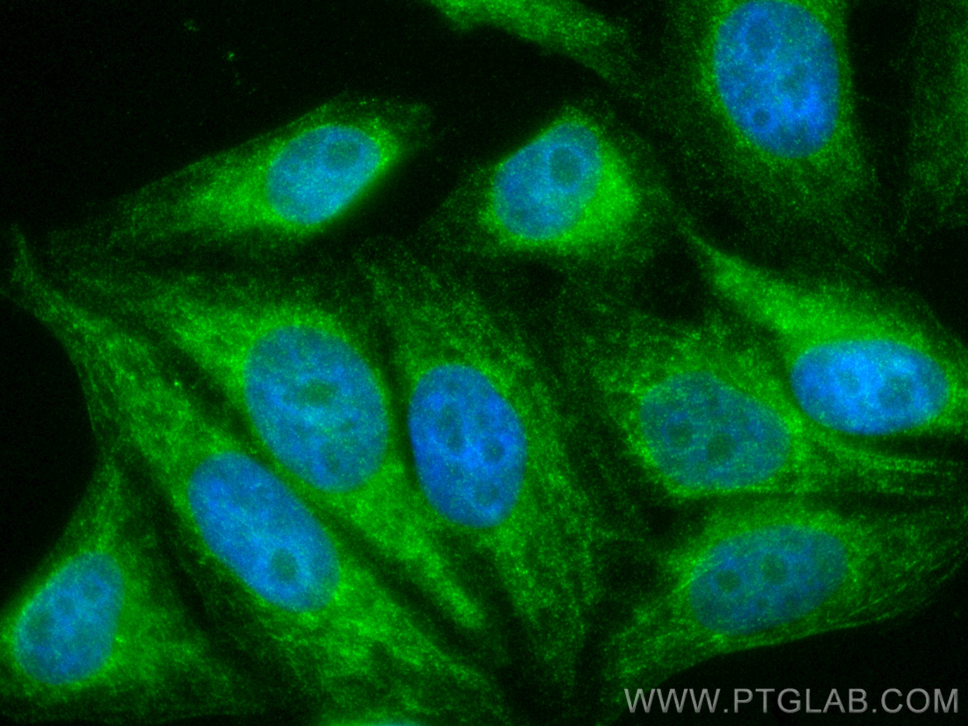 IF Staining of HepG2 using CL488-67757