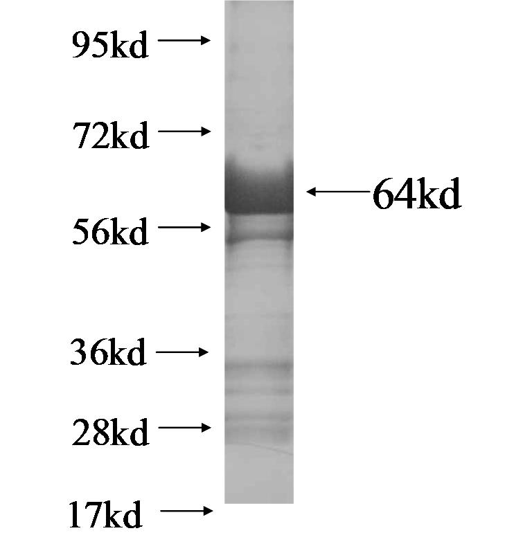 ITCH fusion protein Ag15120 SDS-PAGE