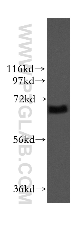 WB analysis of mouse testis using 11731-1-AP