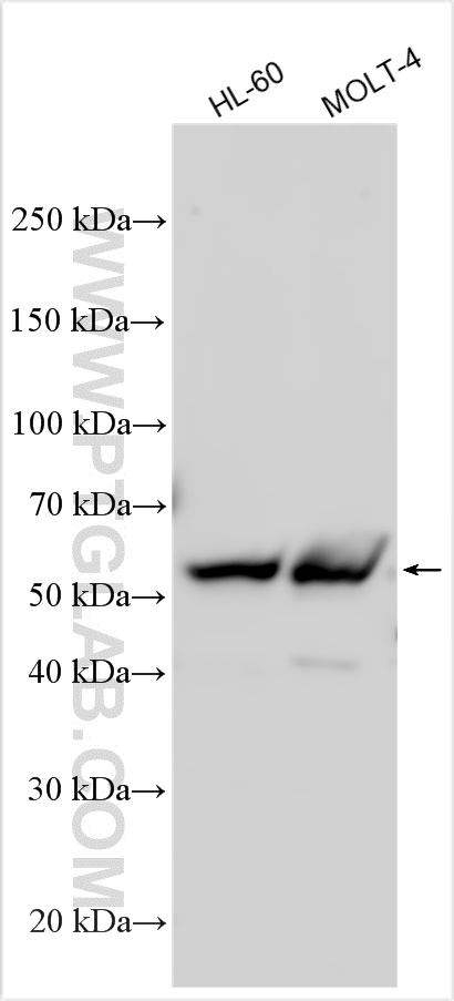 WB analysis using 32836-1-AP