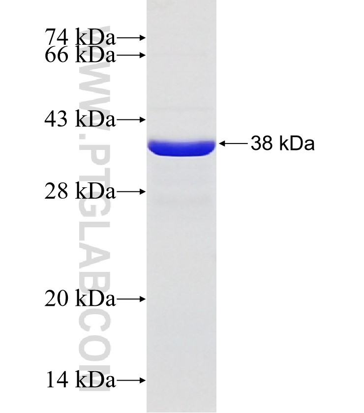 ITFG2 fusion protein Ag31267 SDS-PAGE ITFG2 fusion protein Ag31267 SDS-PAGE