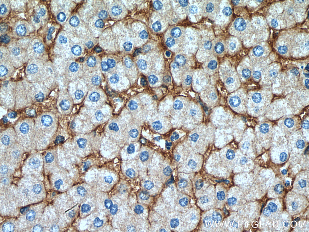 IHC staining of human liver using 22146-1-AP