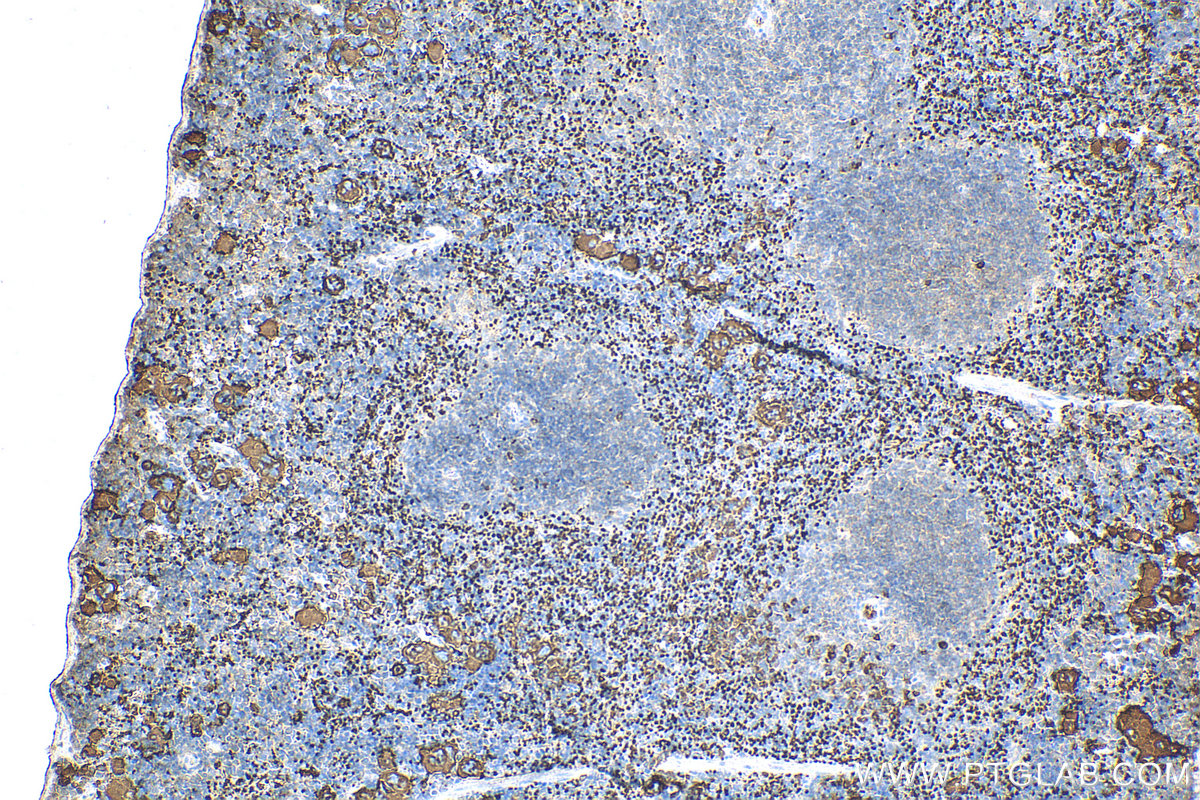 IHC staining of mouse spleen using 24552-1-AP