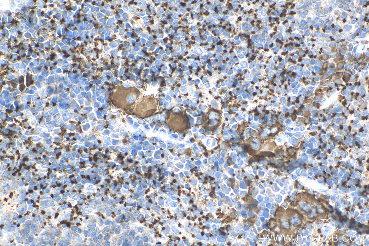 IHC staining of mouse spleen using 24552-1-AP