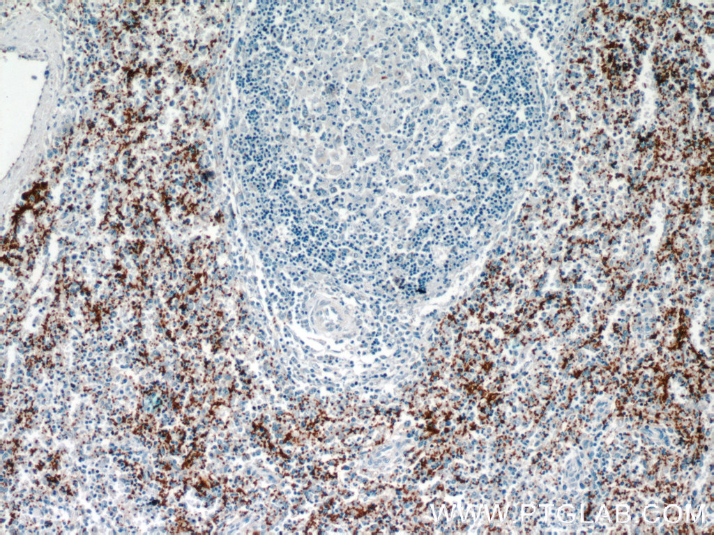 CD41/Integrin Alpha 2B Polyclonal antibody