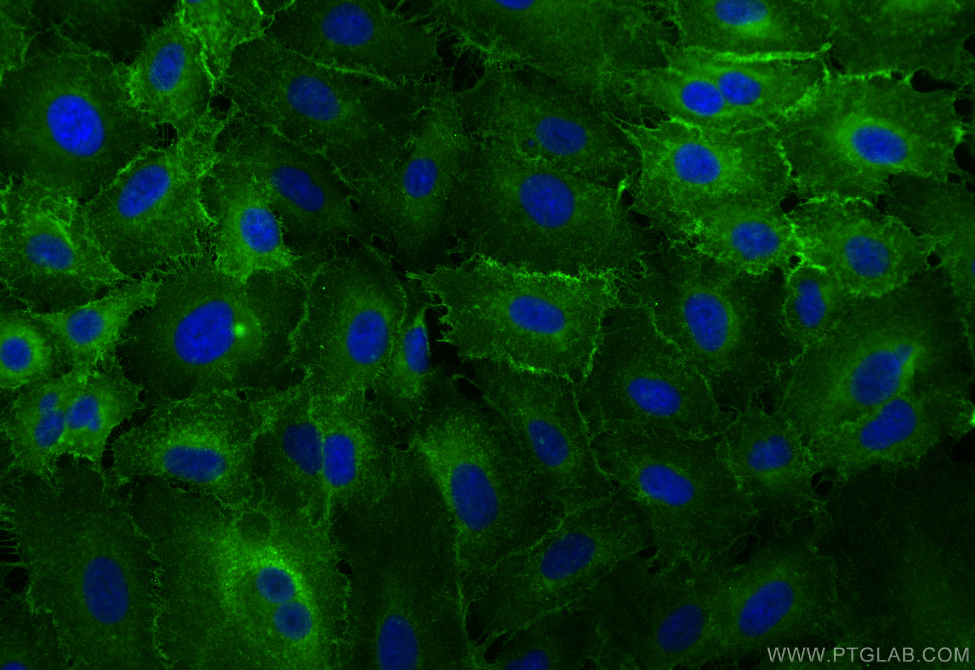 Immunofluorescent analysis of (-20°C Methanol) fixed A549 cells using Integrin Alpha 3 antibody (21992-1-AP) at dilution of 1:400 and CoraLite®488-Conjugated Goat Anti-Rabbit IgG(H+L) (<a class='green' href='/productredirect?CatalogNo=SA00013-2' target='_blank'>SA00013-2</a>). IF Staining of A549 using 21992-1-AP