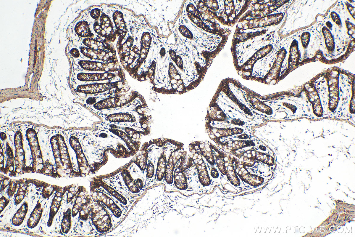 Immunohistochemical analysis of paraffin-embedded mouse colon tissue slide using 21992-1-AP (Integrin Alpha 3 antibody) at dilution of 1:1000 (under 10x lens). Heat mediated antigen retrieval with Tris-EDTA buffer (pH 9.0). IHC staining of mouse colon using 21992-1-AP