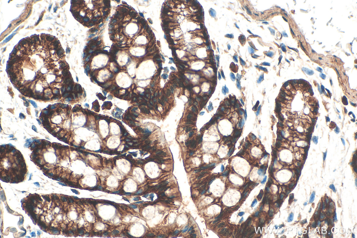 Immunohistochemical analysis of paraffin-embedded mouse colon tissue slide using 21992-1-AP (Integrin Alpha 3 antibody) at dilution of 1:1000 (under 40x lens). Heat mediated antigen retrieval with Tris-EDTA buffer (pH 9.0). IHC staining of mouse colon using 21992-1-AP