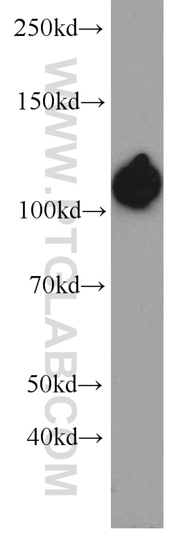 WB analysis of PC-3 using 66070-1-Ig