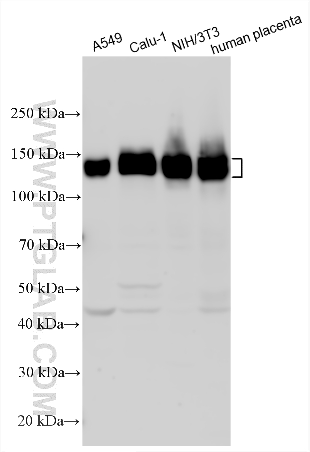 Various lysates were subjected to SDS PAGE followed by western blot with 10569-1-AP (Integrin alpha-5/CD49e antibody) at dilution of 1:4000 incubated at room temperature for 1.5 hours. WB analysis using 10569-1-AP