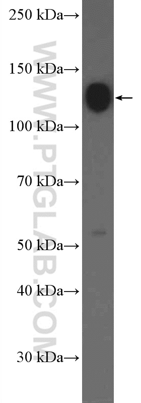 Integrin Alpha 5