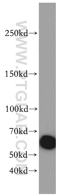 WB analysis of mouse heart using 20232-1-AP