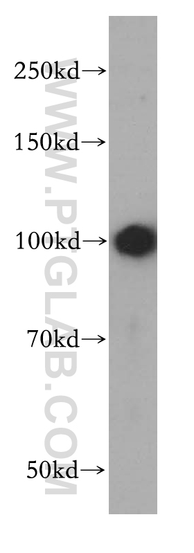 WB analysis of human liver using 14593-1-AP