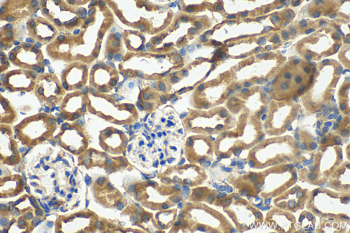 IHC staining of mouse kidney using 27096-1-AP