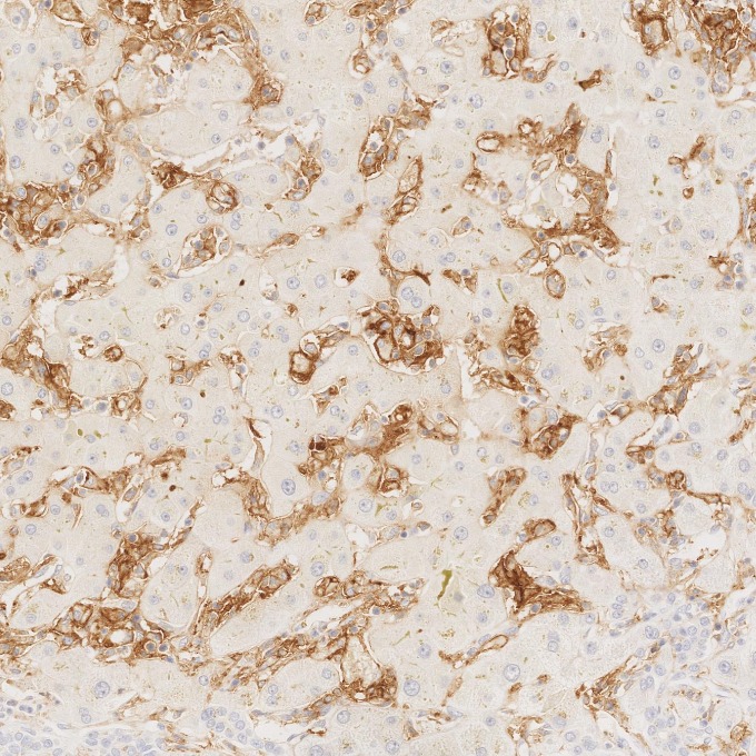IHC staining of human liver using 60258-1-Ig