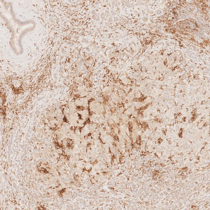 IHC staining of human liver using 60258-1-Ig