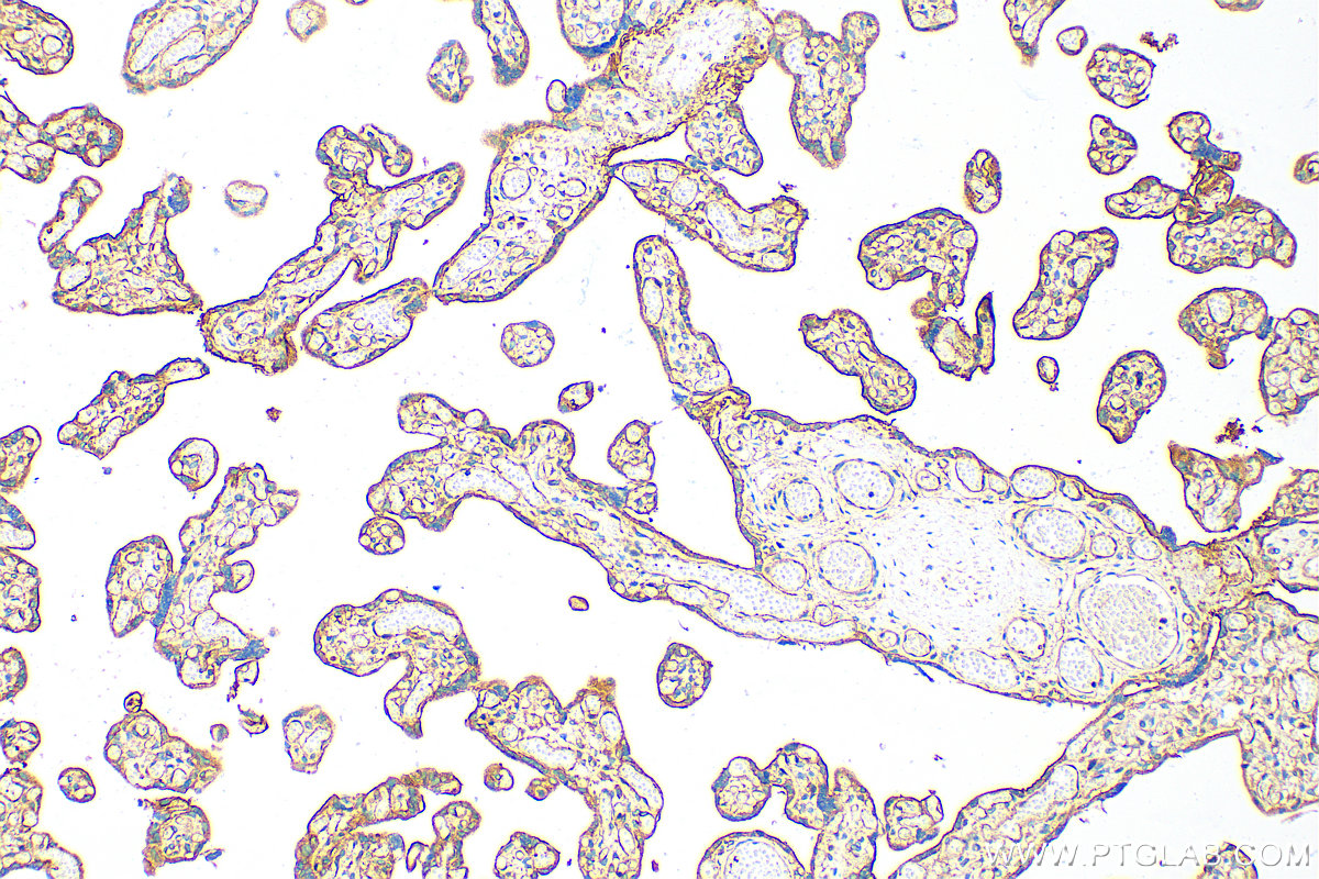 IHC staining of human placenta using 12594-1-AP