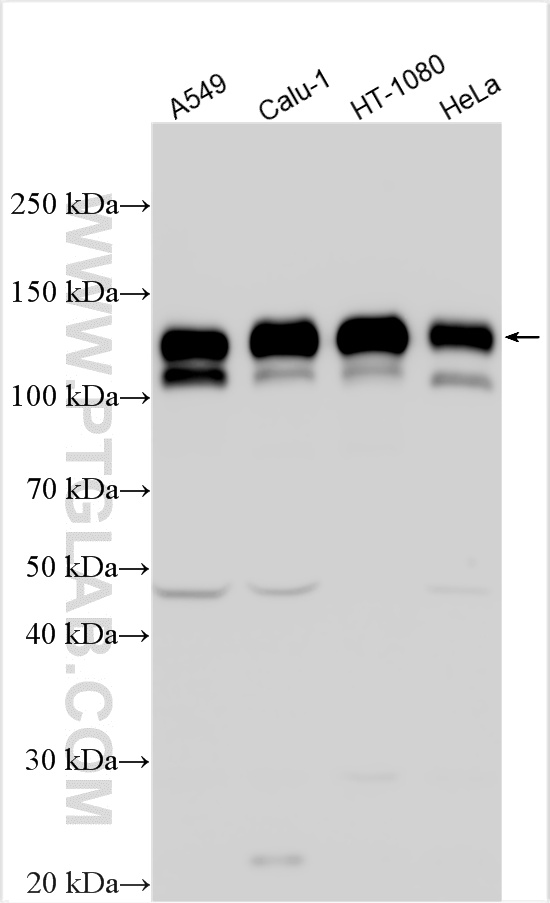 WB analysis using 12594-1-AP