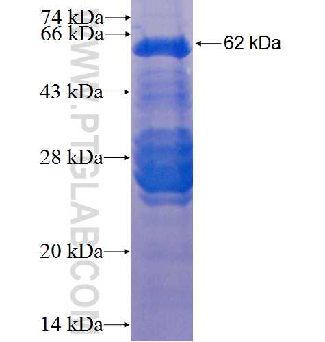 Integrin beta-1 fusion protein Ag3078 SDS-PAGE